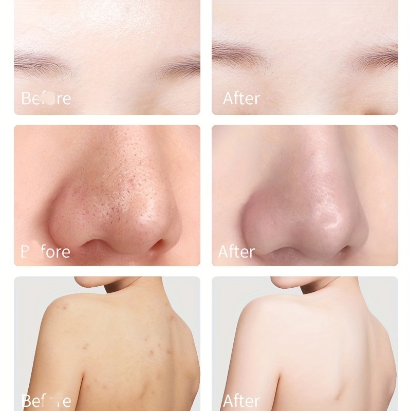Vegan Kojic Acid Soap for Skin Tone Improvement
